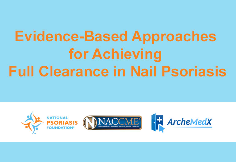 Achieving Full Clearance in Nail Psoriasis